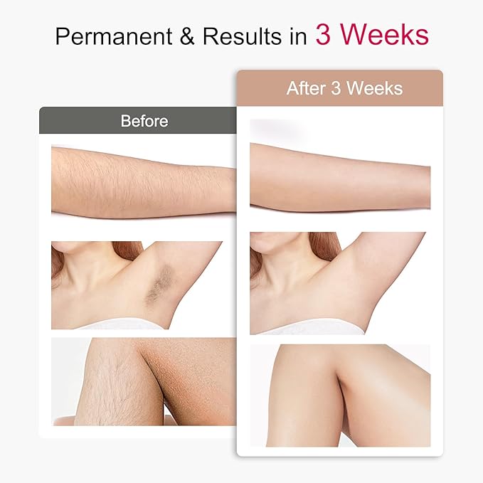 IPL Laser Hair Removal for Women and Men with 5℃ Sapphire Ice-Cooling, Nearly Painless & Long-Lasting Results Hair Removal Device,5 Levels & 2 Modes, 98% Hair Reduction for Fast Full Body From Home