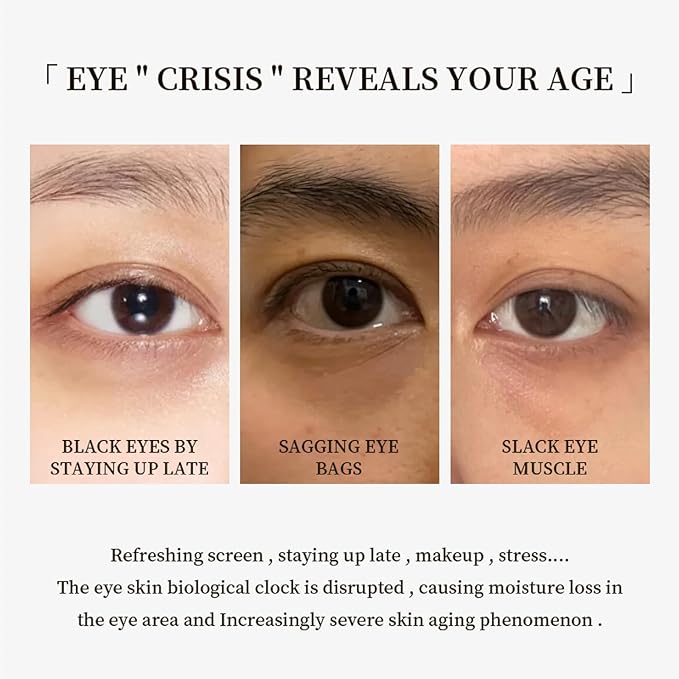 Redcool Eye Cream for Dark Circles and Puffiness - Anti Aging Eye Cream Enriched with VA VC VE, Firming & Hydrating Under Eye Treatment for Wrinkles, Eye Bags, Fine Lines, 30g/1oz