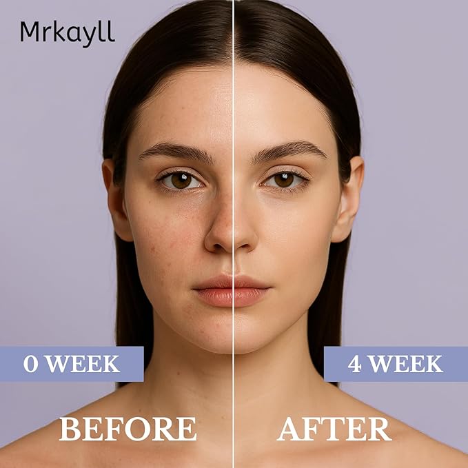 Dark Spot Remover for Face, Dark Spot Corrector - Age Spot Sun Spot Freckles Melasma Brown Spot, Natural Formula: Soothing and Repairing, Anti-Aging and Antioxidant Properties