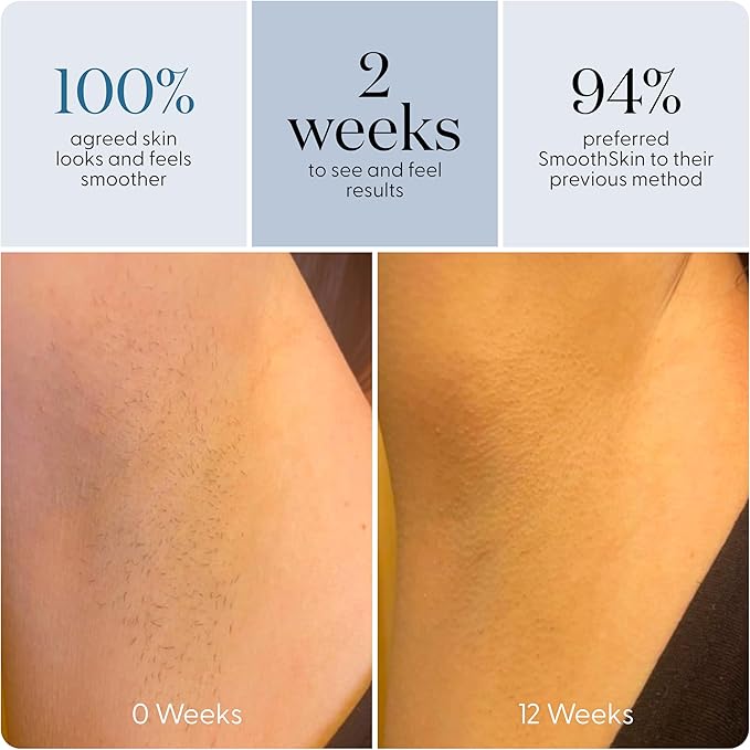 SmoothSkin Pure Adapt Gray IPL Hair Removal Device, At-Home Laser Hair Removal for Women & Men, Visible Results in 2 Weeks, Safe for Face & Body, Painless, Long-Lasting Hair Reduction, Full Body Use