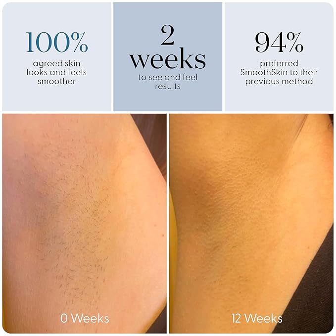 SmoothSkin Pure Adapt Gray IPL Hair Removal Device, At-Home Laser Hair Removal for Women & Men, Visible Results in 2 Weeks, Safe for Face & Body, Painless, Long-Lasting Hair Reduction, Full Body Use