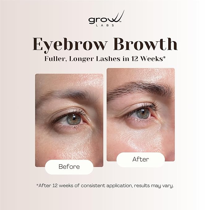 Grow Labs Eyebrow Growth Serum – with Biotin & Peptides – Regrow Eyebrow Hair – Nourishing Formula for Thicker, Fuller, Natural-Looking Brows – Vegan, Cruelty-Free – Made in USA – 5 ml