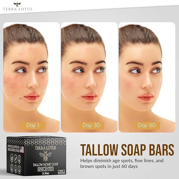 Terra Lotus - Organic Tallow Soap with Organic Castor Oil & Raw Honey - Relief for Dark Spots, Acne Marks, Hydrating & Nourishing - 3 Pack (Unscented)