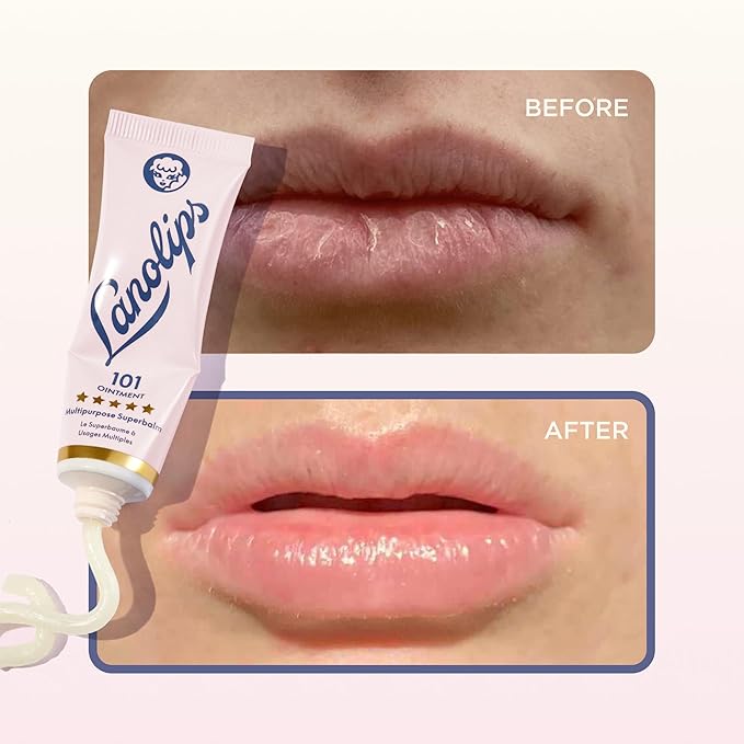 Lanolips 101 Ointment Multi-Balm Duo, Original Superbalm - Contains Pure Lanolin Oil for Smooth, Hydrated, & Healthy Lips - Natural Lip Balm for Dry Lips, Cuticles, & More (2-Pack, 0.52 oz each)