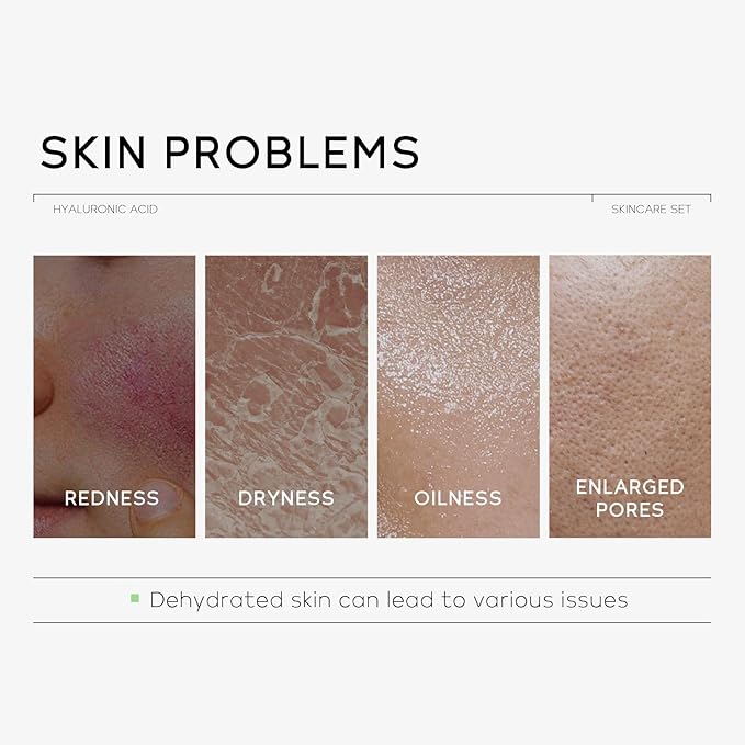 Skin Care Set, Hyaluronic Acid Travel Hydrating