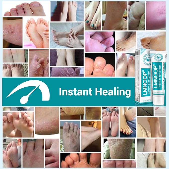 Athletes Foot Treatment Cream, Maximum Strength for Athlete's Foot (Tinea Pedis), Itching, Blister, Burning, Cracking, Scaling, Beriberi,Natural Herbs Antifungal Foot Cream