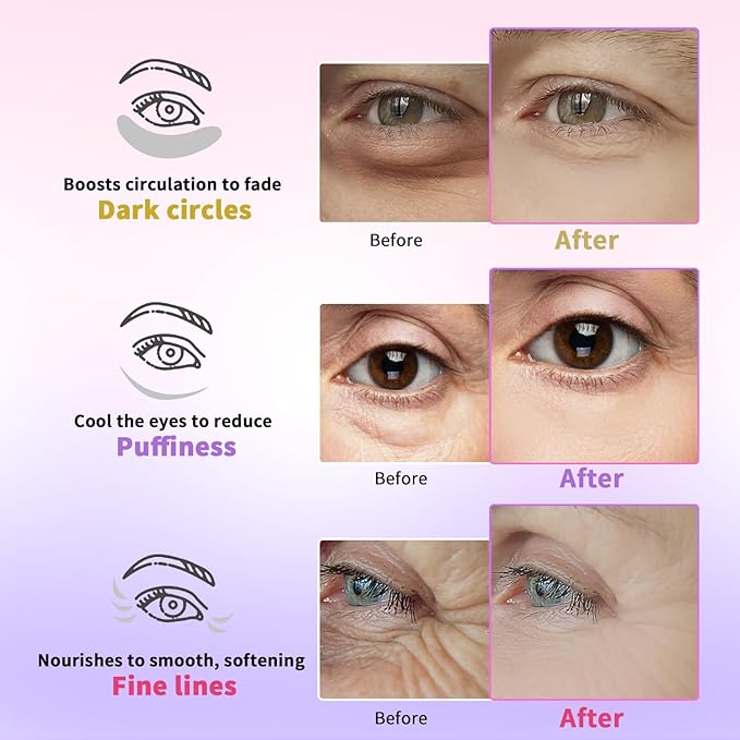 AILEORY Under Eye Patches for Dark Circles, Puffiness, Fine Lines, Eye Mask Set with Retinol, 24K Gold, Caffeine, Valentines Day Gift, Gel Mask for Women & Men, Birthday & Spa Party Favors, 24 Pairs