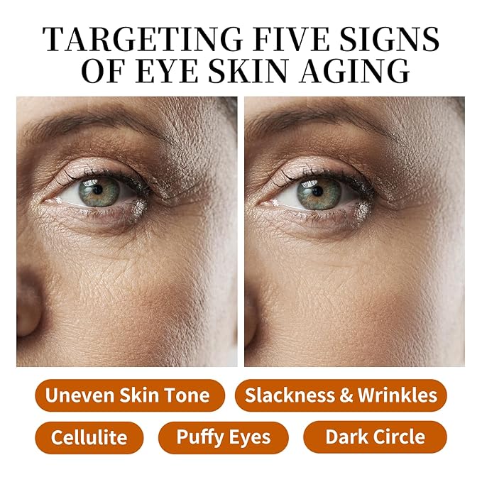 Eye Cream & Roller Serum Set with Retinol,Vitamin E,Squalane, Hyaluronic Acid for Dark Circles, Eye Bags & Fine Lines Under Eyes, Brighten Under Eyes,1OZ&0.27OZ