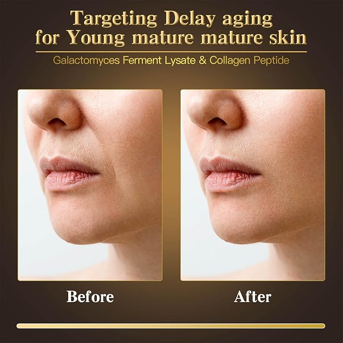 ICIKOL 24K Gold & Caviar Collagen Face Mask, 5 Pack – Luxurious Hydrating Facial Treatment, Firming Appearance – Supports a Radiant, Rejuvenated Look Overnight