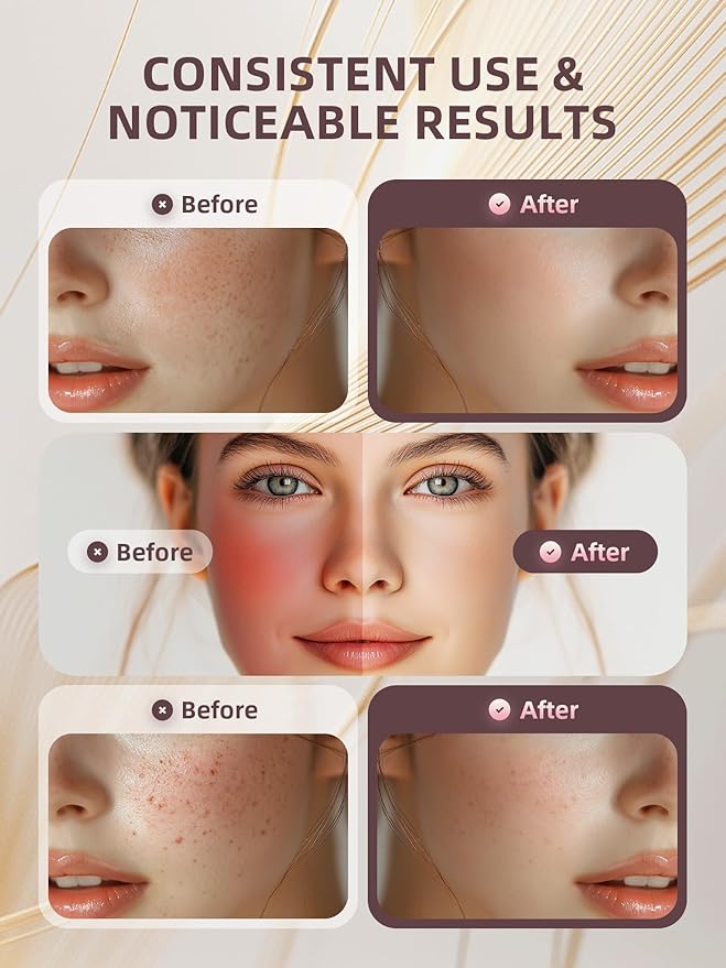 INTEO Multifunctional Facial Massager, Real Glass Glow Device for Face and Neck, Portable Face Massager Tool for Skin Care Pore Care, Enhanced Skin Radiance Effective Against Dullness