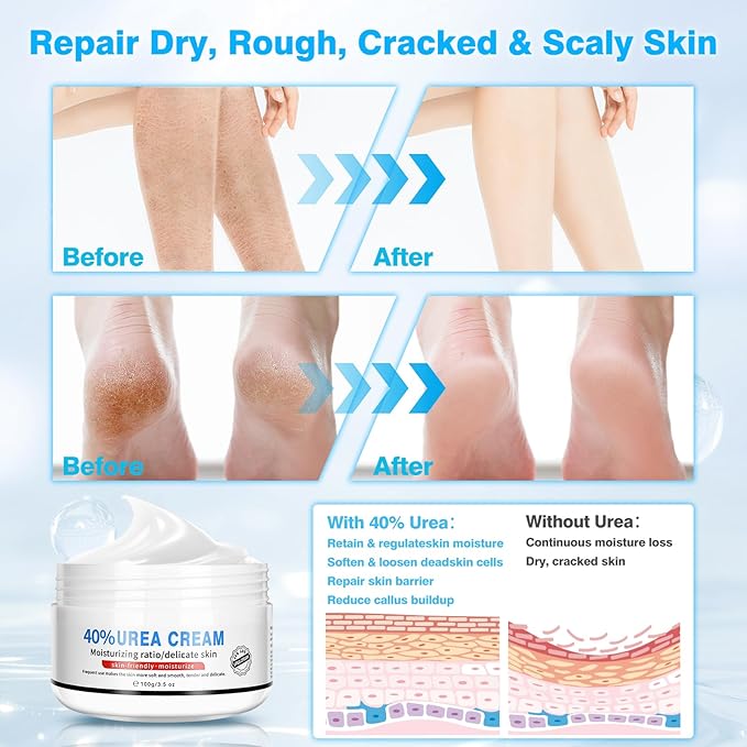 Urea Cream 40 Percent for Feet Maximum Strength, with Moisturizing Heel Socks for Cracked Heel,Foot Cream for Dry Cracked Heels and Feet,Urea Lotion, 3.5 OZ, Foot Files