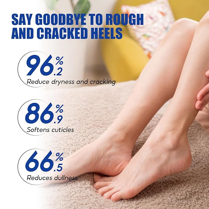 Urea Cream 60% Plus Salicylic Acid 2% - Foot Dry and Cracked Foot Cream, Gentle Exfoliating Moisturizing and Hydrating, Suitable for Feet, Hands and Knees