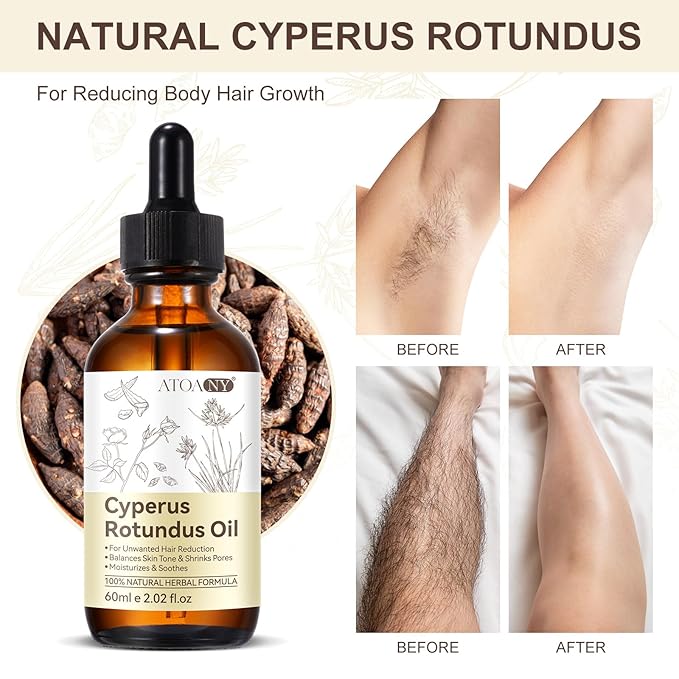 Cyperus Rotundus Oil,Cyprus Oil for Hair Removal,Natural for Reducing Body Hair Growth,Reduces Unwanted Hair Growth,Natural Cyperus Rotundus Oil for Hair Removal,Suitable for All Skin Types