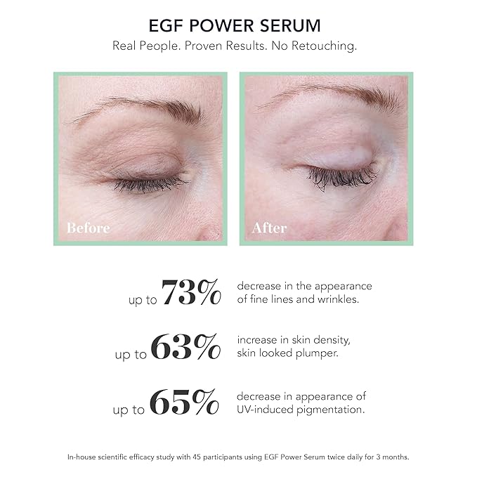 BIOEFFECT EGF Power Serum | Epidermal Growth Factor + KGF + Hyaluronic Acid | Intensive Age-Defying Face Treatment for Deep Wrinkles, Firmness & Skin Renewal, 15 mL / 0.50 oz