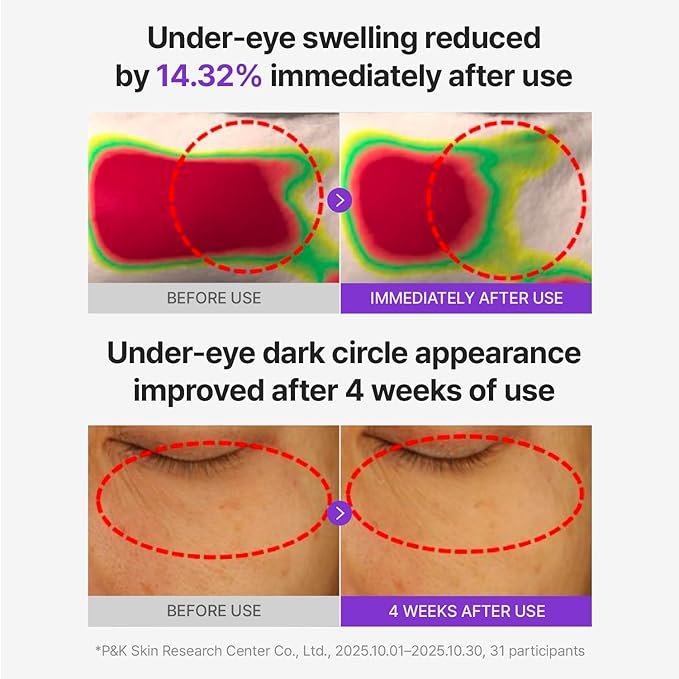 CENTELLIAN 24 360 Shot PDRN Glowing Eye Patch (6 Sets, 12ea) – Instant Depuffing & Dark Circle Revitalizing Hydrogel Under Eye Patches with PDRN, Retinol & Glutathione, Cooling Eye Bags Treatment