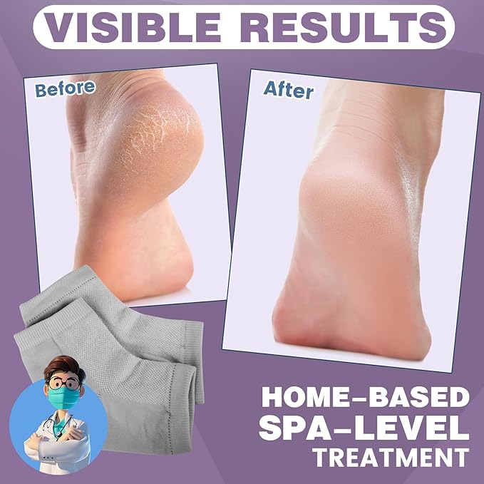 5 Pairs Moisturizing Socks (2 Silicone Socks & 3 Heel Socks) for Dry Cracked Feet, Spa Gel Socks Foot Care After Pedicure, Toeless Socks to Soften and Hydrate Feet Heels