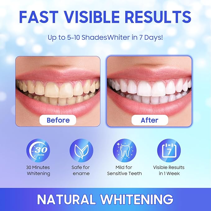 Teeth Whitening Strips 56 Strips (28 Treatments),Peroxide & Sensitivity Free,Enamel Safe with Soothing Natural Ingredients for Deep Stains Removal