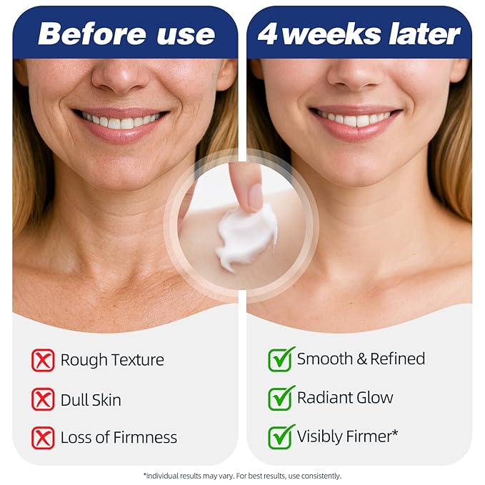 Neck Firming Cream | Face Moisturizer for Women - Anti Aging Formula for Tightening and Firming with Retinol,Collagen,Hyaluronic Acid | Day & Night Moisturizer Suited for Most Skin Types,1.7 OZ