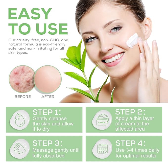 Generic 40 Percent Urea Cream plus 2 Percent Salicylic Acid - for Rough Thick Dry & Cracked Skin - Gently Exfoliates - Feet Hands Elbows - Tea Tree, Aloe Vera - 5.29 Oz(150g), Green