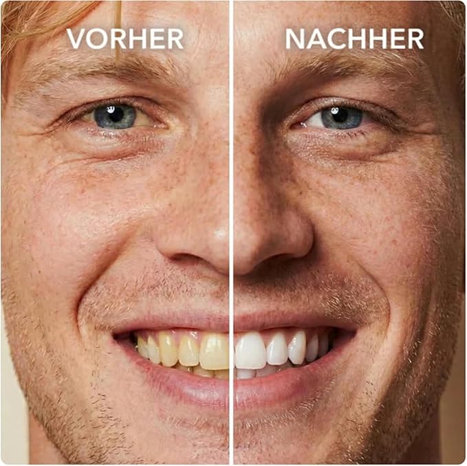 SmileFitPro Tooth Paint, Tooth Polish, Natural Teeth Whitening Paint, Portable Gentle Teeth Whitening Kit, Safe Formula & Long-Lasting Results, 2pcs