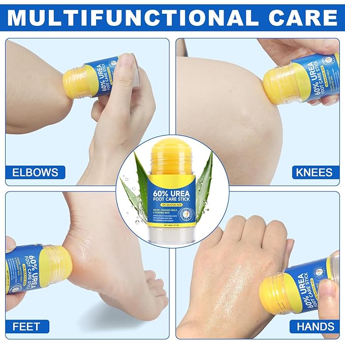 60% Urea with 2% Salicylic Acid Urea Foot Care Stick, Cracked Heel Repair & Deep Moisturizing Treatment for Dry, Rough, Balm for Heels, Elbows, Knees & Hands, Exfoliating Dead Skin, Softening Skin