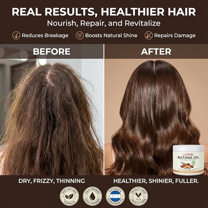 Batana Oil for Hair Growth – 100% Pure & Unrefined Honduran Batana Oil, Cold-Pressed Scalp Treatment for Thick, Strong & Shiny Hair, Batana Hair Oil for Men & Women (7.8 ft OZ)