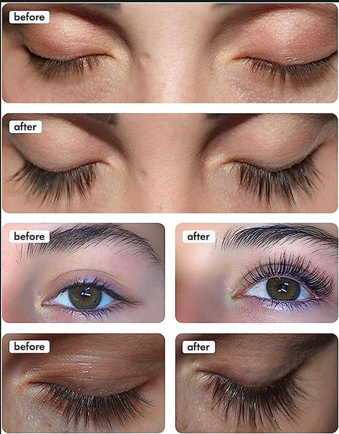 TOPLASH XL Lash and Brow Booster, Growth Serum with Eyelash and Eyebrow Enhancer, Promotes Stronger, Thicker, Healthier Lashes with Botanicals and Peptides - 0,2 Fl Oz(6 ml)