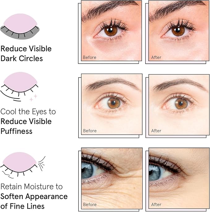 grace & stella Award Winning Under Eye Mask Reduce Dark Circles, Puffy Eyes, Undereye Bags, Wrinkles, Gel Under Eye Patches, Valentines Bags, Gifts Under 10 Dollars, Vegan (6 Pairs, Blue)