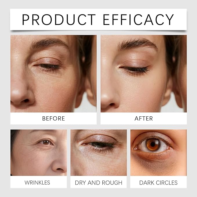 0BtunkIMQH Eye Patches Masks, Calcium Volume Eye Patches For Under Eye Puffiness, Collagen Deep Hydrating Eye Treatment For Men & Women(60 Patches) (2)