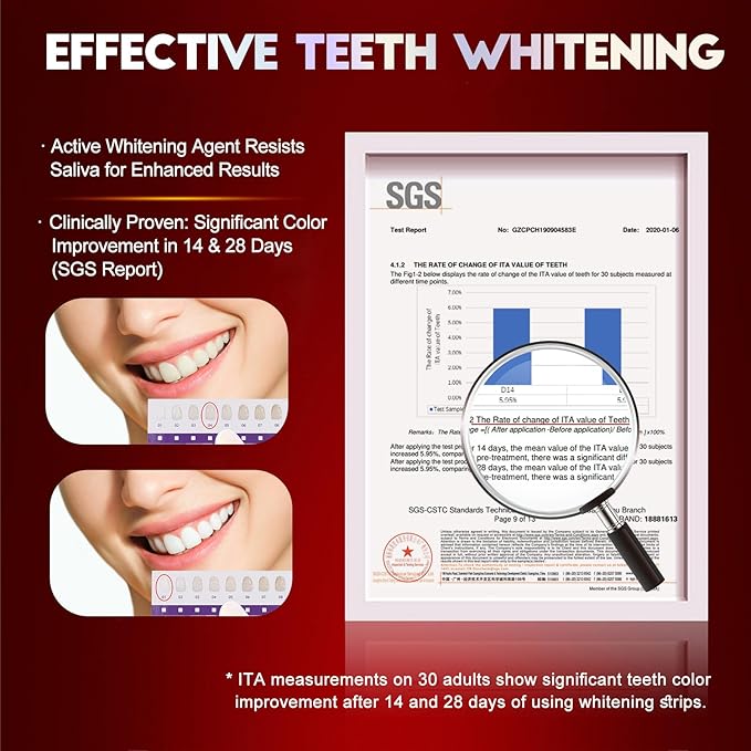Teeth Whitening Strips for Tooth White: Professional Dentist Formulated Teeth Whitener Enamel-Safe Non-Slip 14 Strips 7 Treatments (28 Count (Pack of 1), Mild Mint)