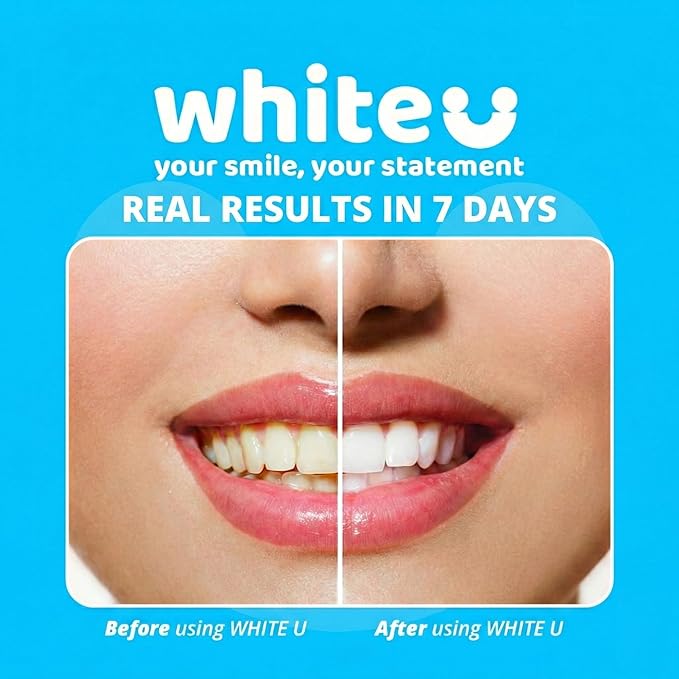 Teeth Whitening Strips for Sensitive Teeth - Peroxide Free No Sensitivity - 14 Strips with Pap+ & Nano Hydroxyapatite - Enamel Safe Whitening in 7 Days - WhiteU
