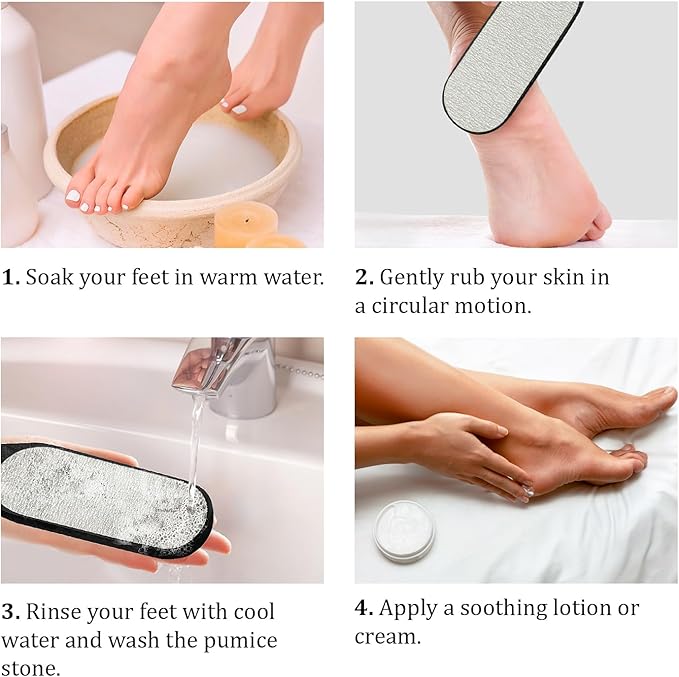 Pumice Stone Foot Scrubber - Pedicure Foot File with Handle for Dry Dead Skin - Callus Remover for Feet - Foot Scraper - Exfoliating Brush for Heels, Elbows, Hands