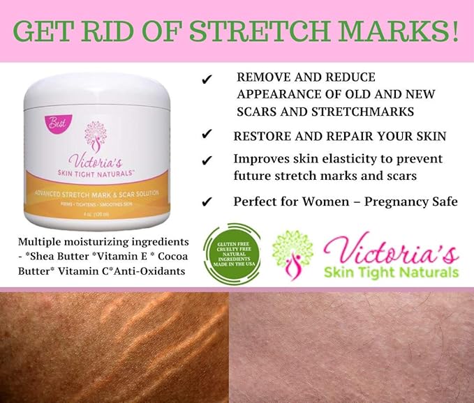 Best Stretch Marks Cream Prevent & Reducing