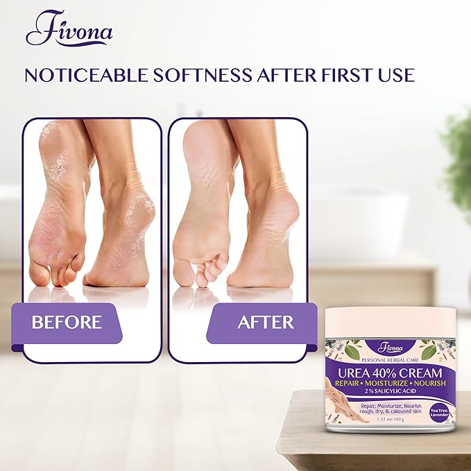 FIVONA 40% Urea Foot Cream for Dry Cracked Heels - Extra Strength Callus Softening Cream with 2% Salicylic Acid, Tea Tree & Lavender, 100g (3.5 oz)