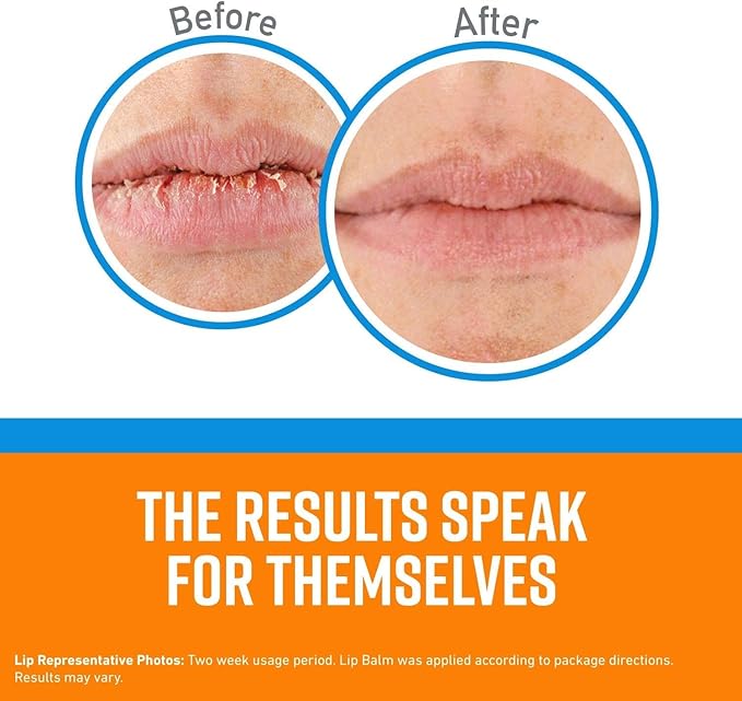 O'Keeffe's Lip Repair No Scent Lip