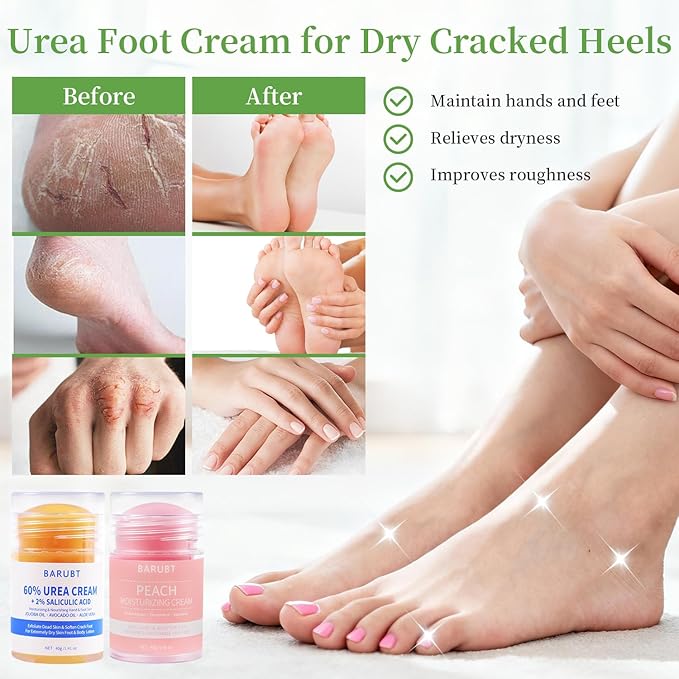 2PCS 60% Urea Foot Cream Stick 2% Salicylic Acid Foot Cream, Urea Foot Care Stick with Moisturizing Heel Socks, Intensive Foot Repair Balm for Exfoliates Dead Skin, Repairs Hydrates Dry, Cracked Feet
