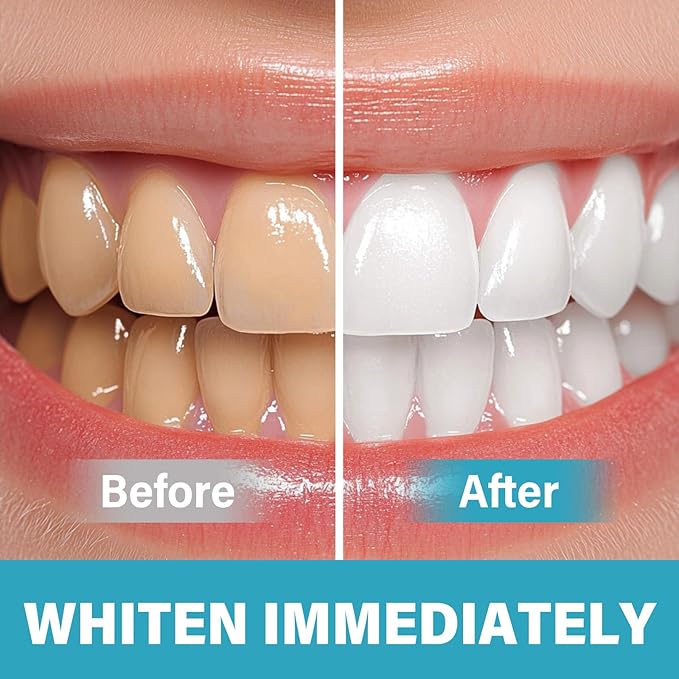 Tooth Paint, Instant Teeth Whitening Paint Kit, White Gel Paint for Teeth, Easy & Fast Get Shiny Teeth, Safe, Assertive Socializing