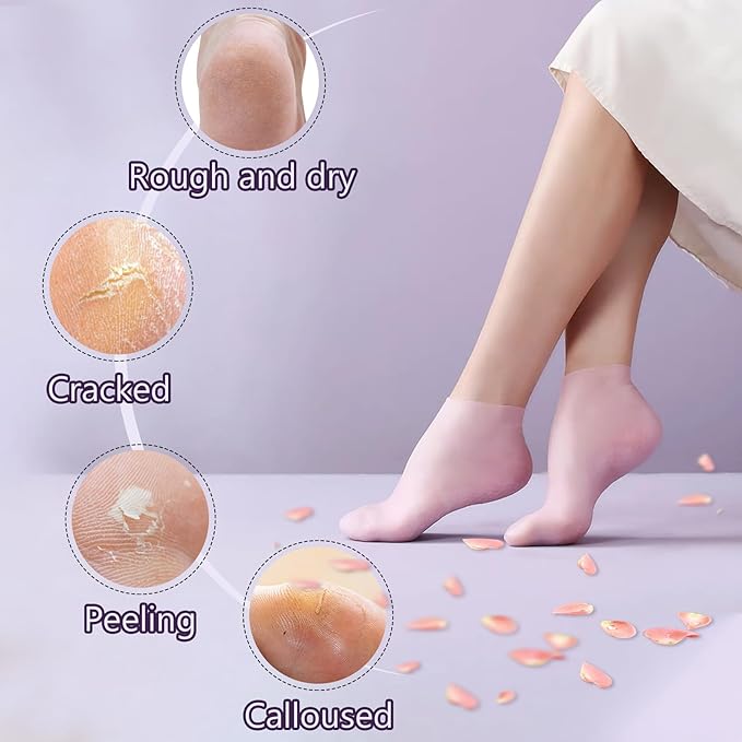 2 Pairs Silicone Socks for Dry Cracked Feet, Women's Foot Socks for Moisturizing (2 Colors Assorted, Fits Up to Size 11)