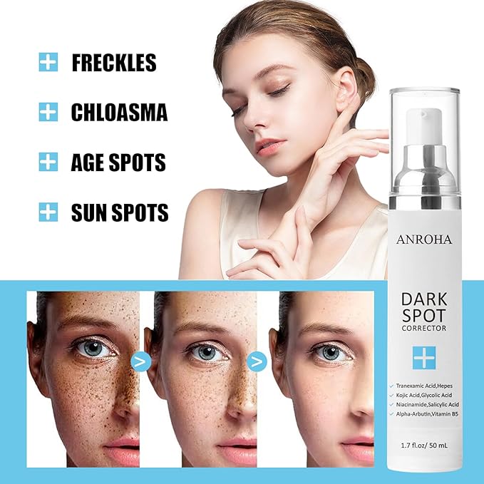 Dark Spot Remover for Face and Body Serum Promotes Anti-Aging Effect - Dark Spot Corrector for Women and Men with Niacinamide Kojic Acid & Salicyic Acid 50ml /1.7fl oz