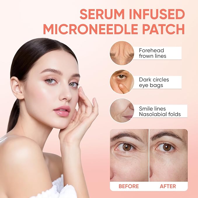 NOVALIFT MicroGlow Eye Patches,Under Eye Patchs Hyaluronic Acid Eye Mask for Dark Circles for Women, Forehead Wrinkle & Smile Line Patches (3BOX(9 Pairs))