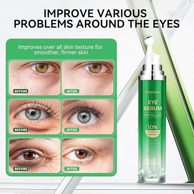 Eye Cream with 5% Caffeine Retinol Hyaluronic Acid, Eye Serum with 360° Roller Massage Ball for Puffy, Bags, Fine Lines, Dark Circles and Wrinkles, Under Eye Treatment Serum for Women & Men