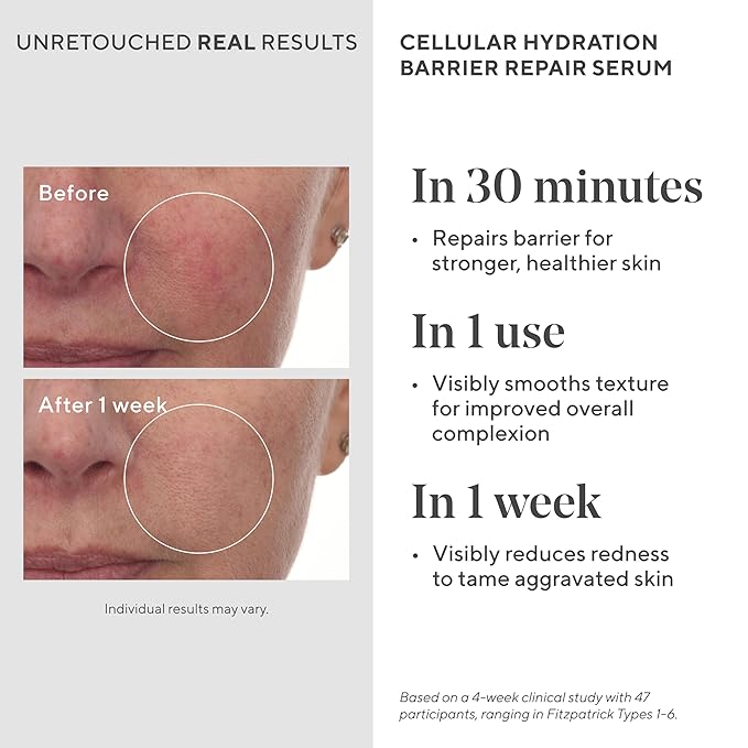 Murad Hydrate Trial Kit – Dewy Skin Set with AHA/BHA Cleanser 2.0oz, Hydration Serum 0.33oz, Hydro-Hyaluronic Cream 0.25oz, Superactive SPF 50 Moisturizer 0.8oz | Travel Skincare for Radiant Skin