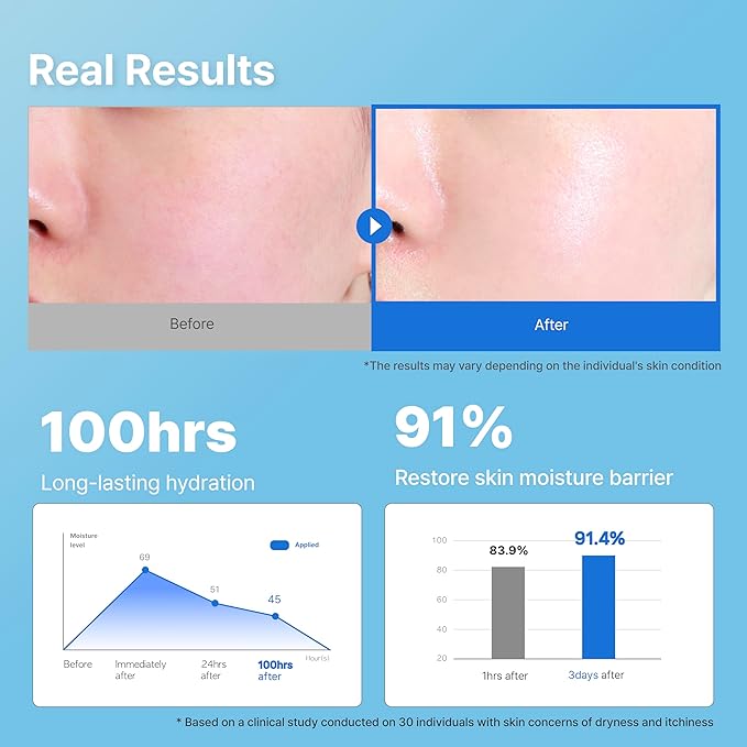 Illiyoon Ceramide Ato Concentrate Cream | Moisturizer for Dry & Sensitive Skin, 100hr Lasting Hydration, For Face & Body, Gentle for Infants, Moisture Barrier Repair, Vegan Certified, 2.53 fl.oz.