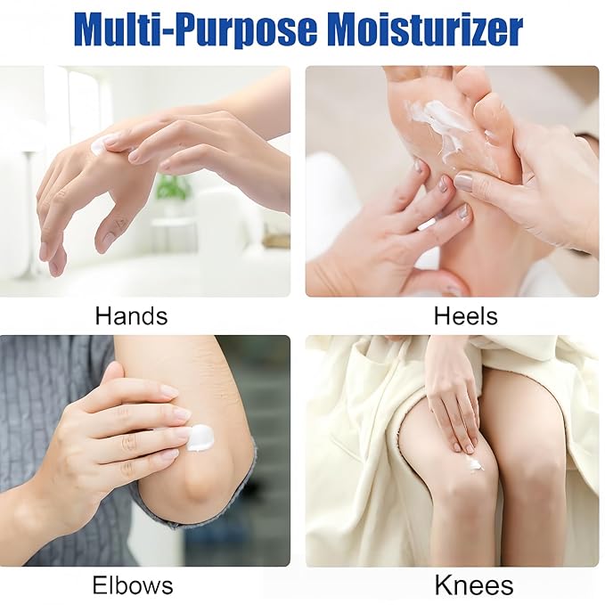 60% Urea Foot Cream – Large Size Foot & Heel Moisturizer with Jojoba Oil, Avocado Oil & Aloe Vera – Foot Lotion for Dry Cracked Feet, Hands & Elbows – 150ML/5.3oz Pump Bottle