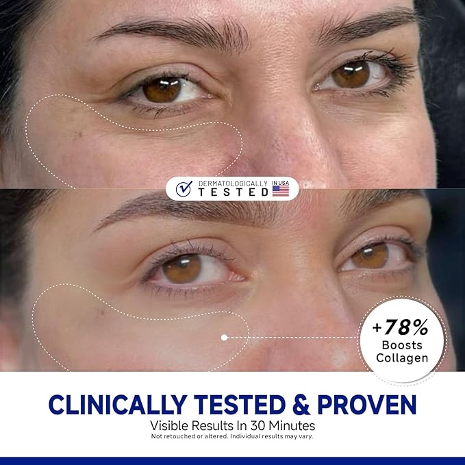 Dr Vincent Peptide Under Eye Patches, Firming Eye Patches Instant Reduces Dark Circles and Puffiness, Collagen Under Eye Mask for Bags Treatment, Wrinkles, 60 Pairs