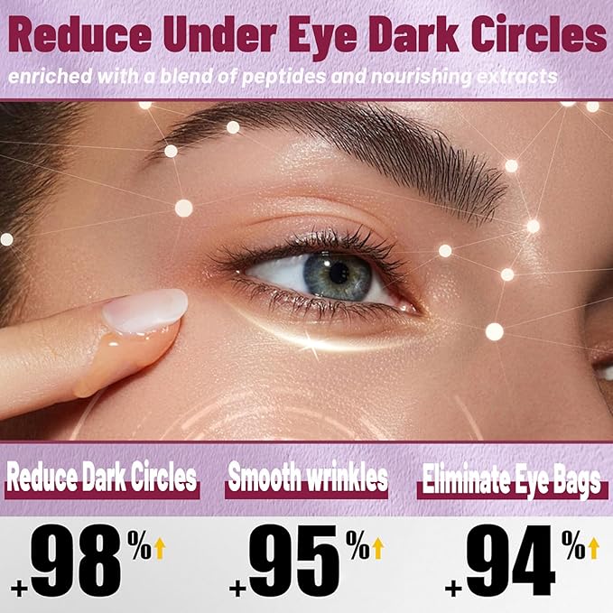 Niptic Dark Circle, Niptic True Tone Eye Cream, Under Eyes Serum for Dark Circles, Eye Repair Cream, Reducing Darks Circle and Puffiness, Repair the Eyes Skin, Reduce Wrinkles (1 PCS)