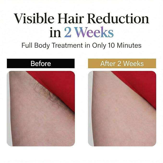 IPL Laser Hair Removal Device for Women & Men, Nex-Gen At Home Laser Hair Removal with 45°F Dual Sapphire Ice Cooling for Painless & Long Lasting Results, Full Body Lazer Hair Removal for Women