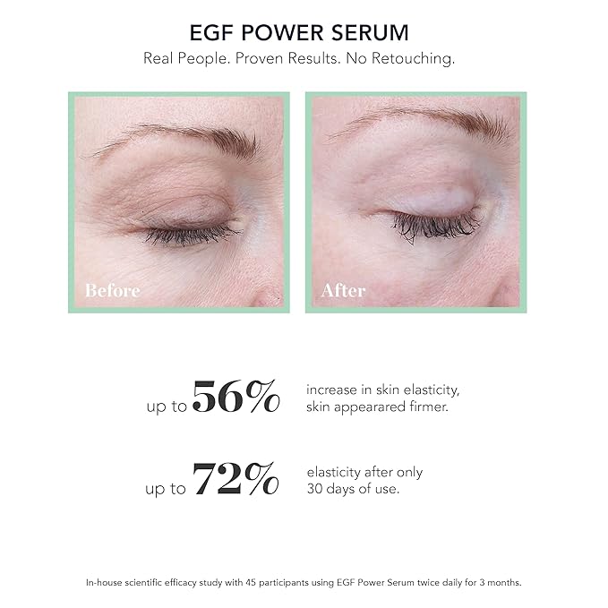 BIOEFFECT EGF Power Serum | Epidermal Growth Factor + KGF + Hyaluronic Acid | Intensive Age-Defying Face Treatment for Deep Wrinkles, Firmness & Skin Renewal, 15 mL / 0.50 oz