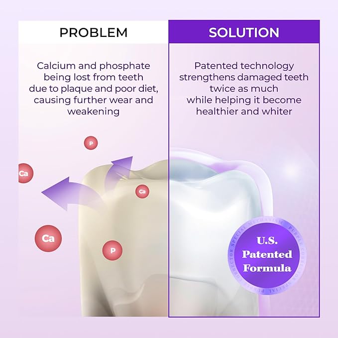HIMALAYA PINKSALT Purple Whitening Toothpaste - Teeth Whitening, Deep Stain Remover with Fluoride, Plaque Remover, Appropriate for Sensitive Teeth, Peroxide Free - Vanilla Mint, 3.5 oz