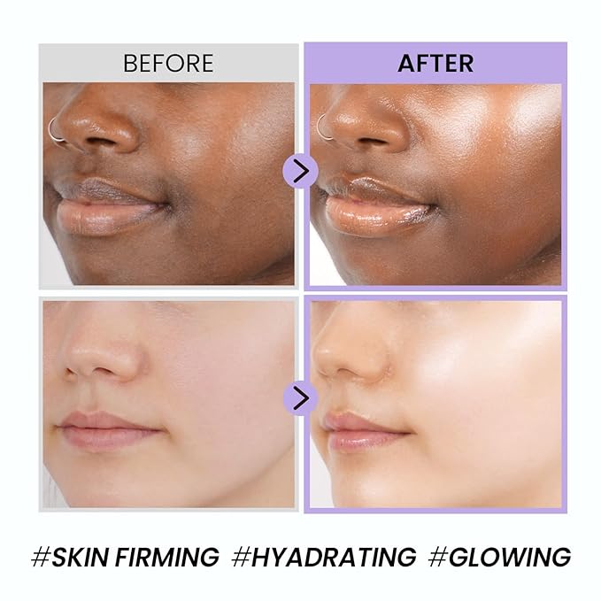 coxir BLACK SNAIL GIFT SET /Gift